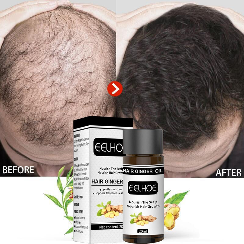 Hair Growth Essential Oils Products Ginger Fast Growing Hair Anti Hair Loss Serum Prevent Baldness Treatment Liquid Men Women