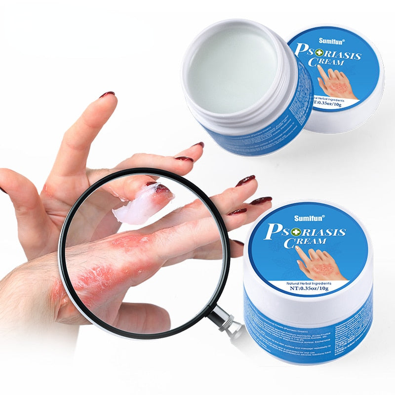 Sumifun Psoriasis Cream Scalp Dermatitis Medicine Medical Eczema Rapid Treatment Herbal Ointment Medical Itching Skin Care 2023