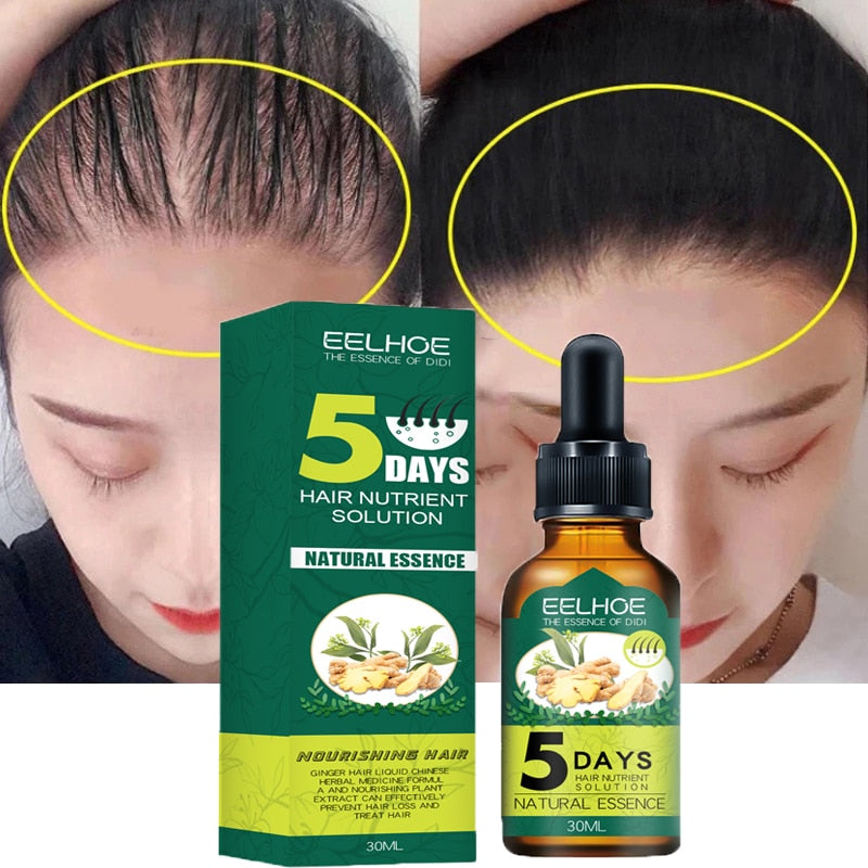 5 Days Ginger Hair Growth Products Natural Anti Hair Loss Prevent Baldness Treatment Fast Growing Nourish Dry Damaged Hair Care